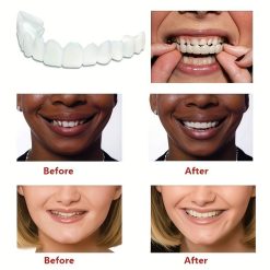 Couvre dents pour un sourire parfait