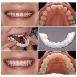 Couvre dents adapté à tous