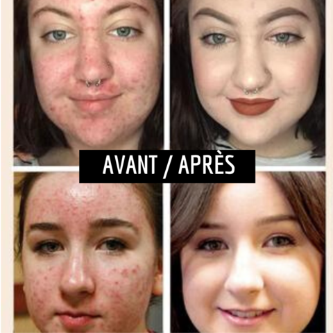 Fond de teint avant et après