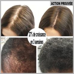Avant et après utilisation du sérum après 3 semaines