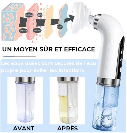 Nettoyeur de Visage Hydro démontage 