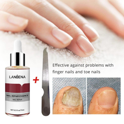 LANBENA-Sérum réparateur pour les ongles