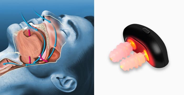 Utilisation simple du dispositif anti-ronflement SleepLux pendant 10 minutes avant le coucher.