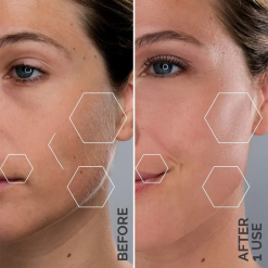 eau du visage après dermaplaning, aspect plus lisse