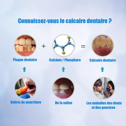 démonstration des calcaire dentaires
