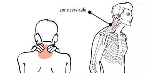 cervelaxe zone cervicale